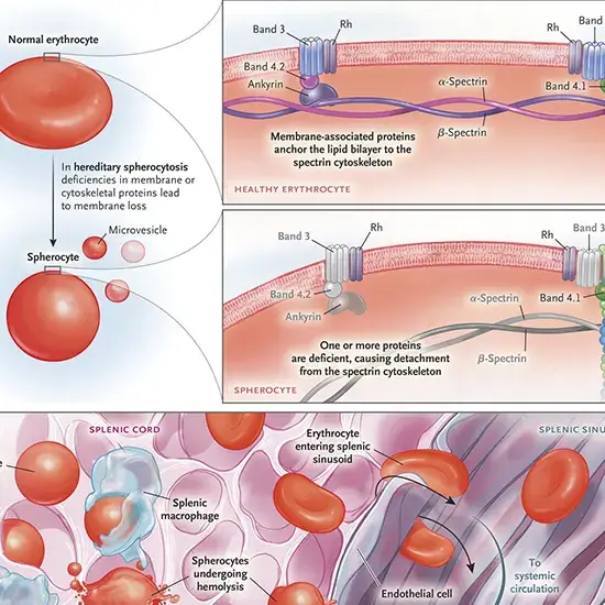 osmotic fragility test